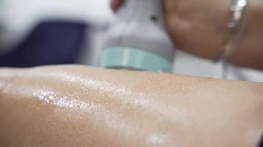 Modern kozmetoloji kliniğinde kriyolipolisis yağ tedavisi prosedürü. Genç bayanın bacağına cerrahi liposakşın yapılmamış. Güzellik konsepti. 4K görüntüsünü kapat.