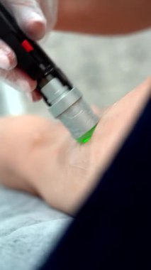 Profesyonel kozmetolojistin modern güzellik kliniğinde bacak kesen genç bayana İskenderiye lazeri yaparken dikey yakın çekim videosu.