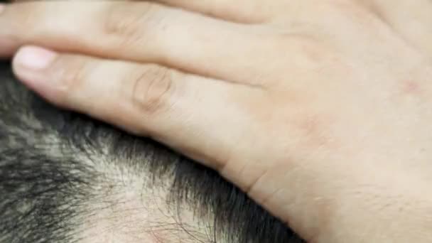 Close Young People Have Problem Hair Loss Dryness Dullness Split — Stok Video