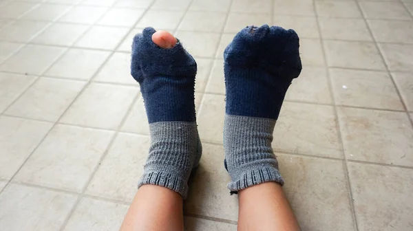 Blauwe Sokken Met Een Gaatje Teen — Stockfoto