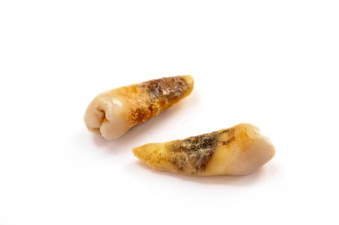 Kötü ağız hijyeninden dolayı diş bakımı veya çürüğü olarak da bilinen, beyaz arka planda izole edilmiş, yakın plan dişli bir diş.