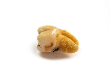 Kötü ağız hijyeninden dolayı diş bakımı veya çürüğü olarak da bilinen, beyaz arka planda izole edilmiş, yakın plan dişli bir diş.