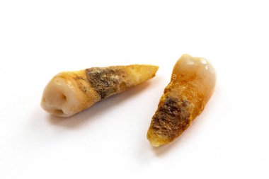 Kötü ağız hijyeninden dolayı diş bakımı veya çürüğü olarak da bilinen, beyaz arka planda izole edilmiş, yakın plan dişli bir diş.