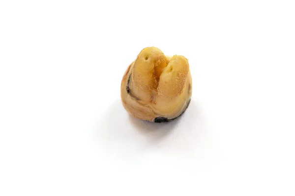 Dente Perto Com Cárie Dentária Severa Também Conhecida Como Cárie — Fotografia de Stock