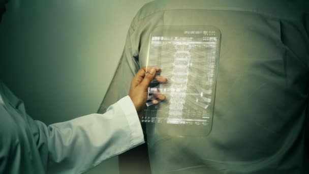 医生用先进而透明的X光片扫描病人脊椎以寻找椎间盘突出症迹象的前瞻性概念 — 图库视频影像
