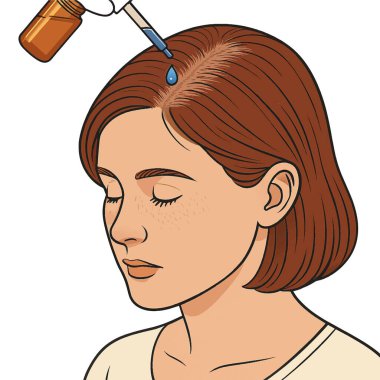 Saç dökülmesi tedavisi gören bir kadının vektör çizimi. Beyaz arka planda izole tasarım. Sağlık veya dermatoloji görselleri için ideal.