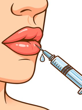 Vektör illüstrasyonu, alt dudağa şırıngayla yaklaşan bir kadının dudaklarını gösteriyor. İğnenin ucunda küçük bir damla dolgu maddesi görünür. Beyaz arkaplanda izole tasarım.