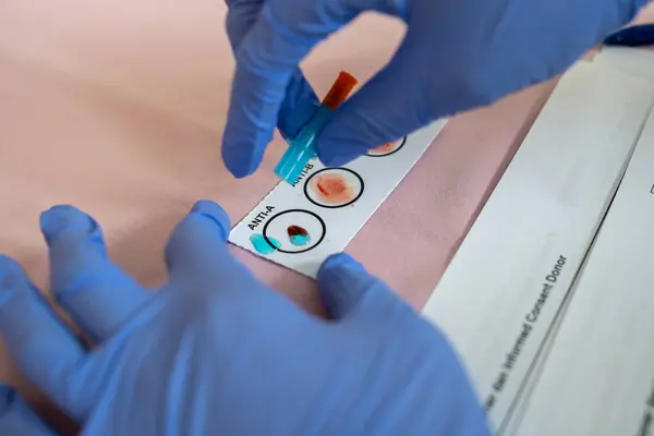 Bir sağlık çalışanı kan grubu testi serumunu bir laboratuvar ya da hastane kliniğinde kan grubu kontrol kağıdına damlatıyor.
