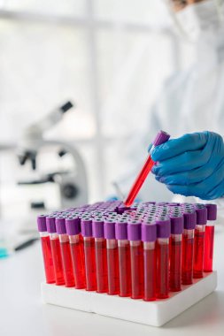 Asyalı hematolog, bir doktorun talimatlarına göre tıbbi olarak gerekli kan testlerini inceler. Kan testlerini teşhis etmeye çalışır, laboratuar yakın çekim fotoğraflarını çeker.