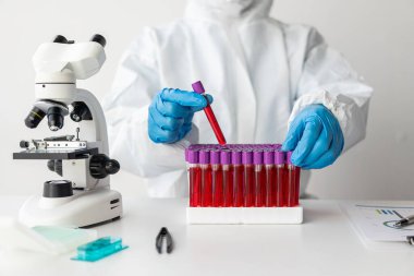 Asyalı hematolog, bir doktorun talimatlarına göre tıbbi olarak gerekli kan testlerini inceler. Kan testlerini teşhis etmeye çalışır, laboratuar yakın çekim fotoğraflarını çeker.