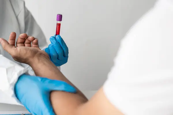 Hematologista Asiático Examina Exames Sangue Clinicamente Necessários Ordenado Por Médico — Fotografia de Stock