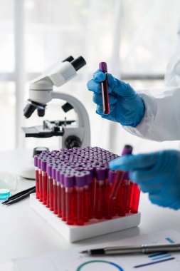 Hastane doktoru laboratuvarda kan damarı testi yaptı. Raftan alınan kan örneğiyle laboratuvarda analiz cihazı bulundu.