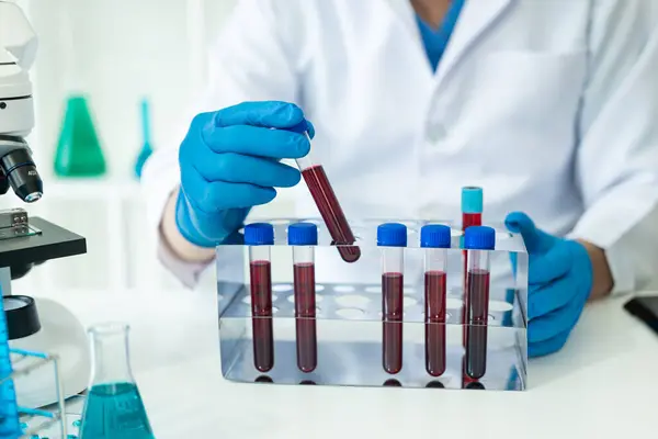 Kórházi Orvos Vérérvizsgálatot Tart Laboratóriumban Polcról Vett Vérmintával Analizátorral Laborban — Stock Fotó