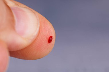 Detaylı bir yakın plan fotoğrafı beton bir masada kan damlasını gösteriyor. Şeker hastalığı kontrolü için glikoz testini vurguluyor.