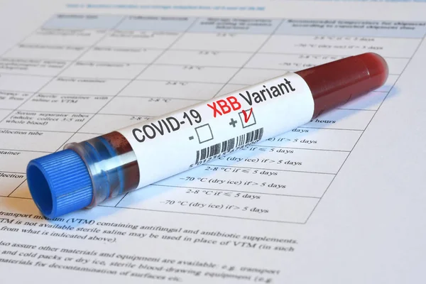 Bloedbuis Voor Detectie Van Virus Covid Xbb Variant Met Positief — Stockfoto