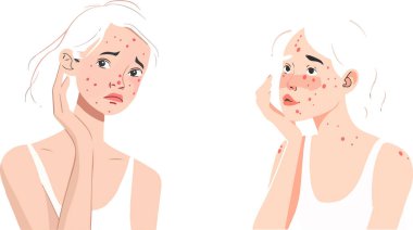 Bu minimalist vektör sanatı akne ve deri sorunları olan ilgili bir kadını tasvir ediyor. Bu anlamlı illüstrasyon cilt sorunlarının duygusal etkilerini vurguluyor ve sağlık ve güzellik temaları için ideal hale getiriyor..