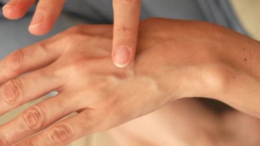 Kadın Ellerinin Genel Görünümü Şeffaf Jel Dermatolojik Terapi Konsepti Uygulaması