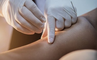 Kadın hastanede masaj yaptırıyor, seçici odaklanma.