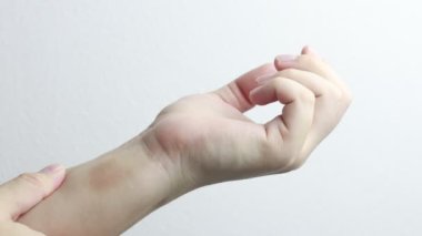 Spor kazasından dolayı kolunda oluşan çürük yakın plan görüntüsü. Masaj ve dış ilaçla ilgilenmek.