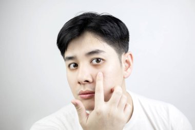 Genç Asyalı bir adamın portresi beyaz arka planda hassas cildin etrafında koyu renk bir çember çiziyor. Sağlık hizmeti kavramı yetersiz dinlenme, uykusuzluk, endişe ve stres