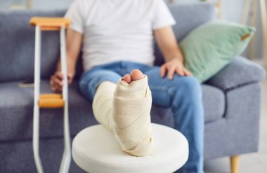 Beyaz sandalyenin alçısında kırık bacak, yakın plan. Bandajlı ve koltuk değnekli bir adam evdeki koltukta oturuyor. Yaralanma için tıbbi bakım. Travmatolojide danışmanlık.