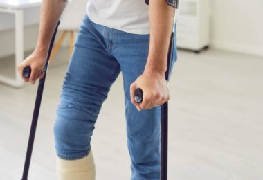 Kırık bacak ya da ayak sakatlığı olan, koltuk değnekleriyle yürüyen, bacağı bandajlı, rehabilitasyon sürecinde olan hasta, ayağı şişmiş, üzerinde yürüyemeyen insan, ciddi kırıklar, koruyucu kılıf.