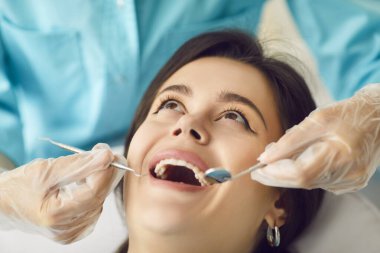 Genç bir kadının diş hekiminin sandalyesinde ağzı açık otururken, dişçi dişlerini ağız aynasıyla incelerken başını kaldırıp gülümsediği yakın plan bir fotoğraf. Sağlıklı dişler ve ağız sağlığı konsepti.