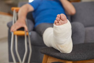 Ev oturma odasındaki kanepede dinlenen bir adamın bandajlı kırık bacağını yakından çek. Travma veya yaralanmadan sonra tıbbi tedavi ve rehabilitasyon, bacağın iyileşme için yükseldiğini gösteriyor..