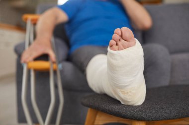 Close-up of a man broken leg in a bandage resting on a sofa at home living room. Medical treatment and rehabilitation after trauma or injury, showing the leg elevated for recovery. clipart