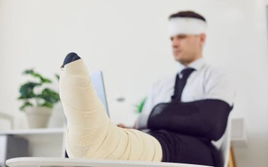 Rehabilitasyon sırasında evde çalışan kırık bacaklı ve bandajlı sakat bir iş adamının ayak görüntüsü. Yaralı kolunda alçılı bacağı ve hareketsizleştiricisi olan sakat bir adam..