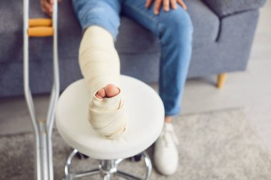 Evdeki kanepede oturan kırık ve bandajlı bir adamın yakın çekimi. Bir yaralanma veya travma sonrası rehabilitasyona uğruyor, tıbbi iyileşme sürecini ve tedaviyi vurguluyor.