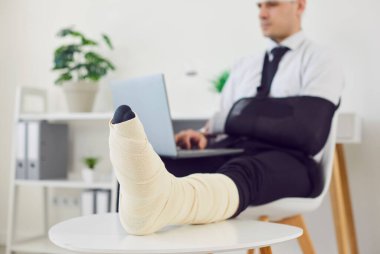 Ciddi bacak, kol travması, fiziksel kaza, dizüstü bilgisayarla çalışma sonrası ofis çalışanı rehabilitasyonu. Alçıda bacağı kırık bir erkek hasta. Oturma, ayak, el kemiği kırığı, iş yerinde dinlenme. 