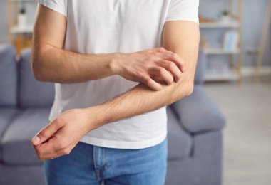 Adam alerjik deri reaksiyonundan ya da böcek ısırığından dolayı sol elini kaşındırıyor. Sıradan giysiler içinde kolunda kaşıntı ve rahatsızlık hisseden bir adamın görüntüsü. Rahatsız edici duygular..