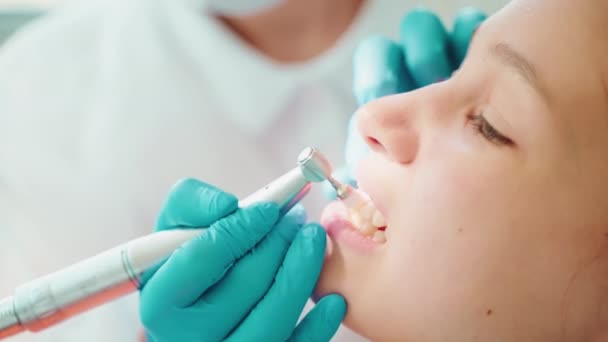 歯科医院で子供の少女の歯を治す間に歯磨きプロセスのクローズアップビュー 治療中に静かに座って歯のエナメルを白くする10代の少女 プロの歯科ケア — ストック動画