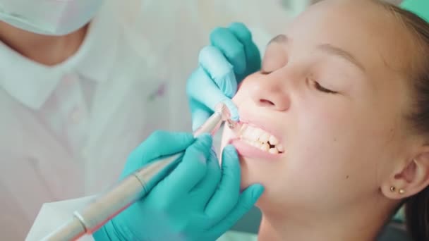 Отбеливание Профессиональная Чистка Зубов Стоматологической Клинике Детей Стоматолог Полировка Зубов — стоковое видео