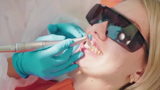 現代歯科医院の専門の歯のクリーニング 大人の女性患者の歯のエナメルを磨く歯医者 閉鎖の眺め 歯の健康および美を救うための現代技術そして装置 — ストック動画