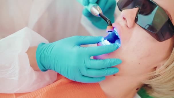 牙科医生在牙科诊所为妇女安装了光固化聚合物封条 并进行了密切合作 胃科医生在口腔科诊所用紫外光聚合光固化封条 腔内治疗 — 图库视频影像