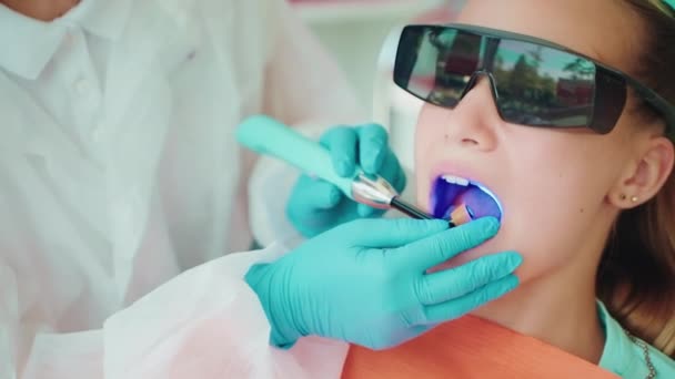 小児歯科の歯科治療ライト 歯科用充填のポリマー化のために青いランプを使用した歯科医 現代技術の子供のための近代的な歯科医院の歯科修復 — ストック動画