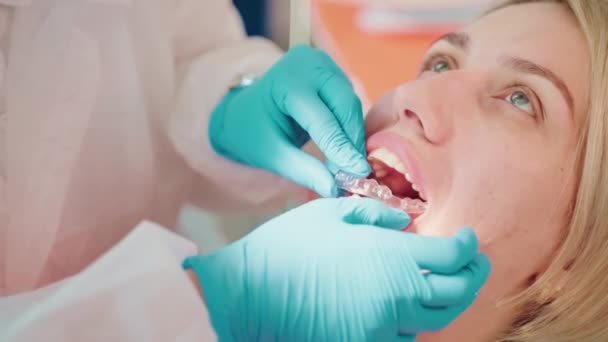 Estomatologista Instalando Alinhadores Claros Dentes Mulher Adulta Tecnologia Moderna Para — Vídeo de Stock