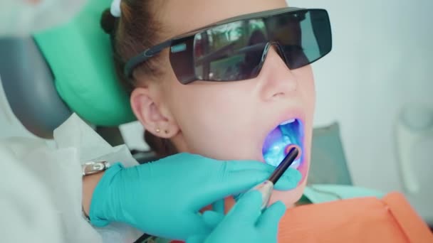 歯科医は 患者10代の少女に歯科に光合成シールを設置しています 気象学者は 紫外線を使用して 体外科クリニックで光硬化シールの重合を硬化させます キャビティ治療 — ストック動画