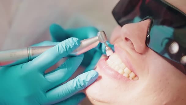 歯科衛生士は女性のための歯科の口腔衛生クリーニングを作ります 歯と口を閉じる 専門の電気歯科ドリル機械を使用して診療所の歯をブラシをかける病理学者の医者 — ストック動画