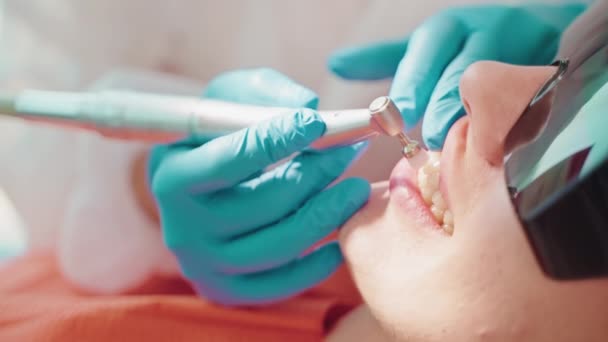 歯科医院の専門の歯のクリーニングのクローズアップの眺め 歯の健康そして美しさ 歯科の現代処置 前歯のエナメルを磨く医者 — ストック動画