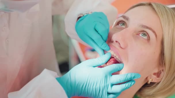 歯科矯正歯科医は 歯科の女性に取り外し可能な透明アライナーを取り付けています ストーマトロジークリニックにおける矯正治療 歯のアライメント — ストック動画