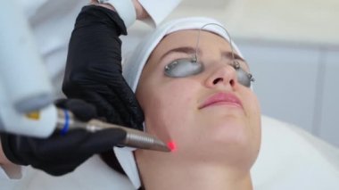 Estezi uzmanı, modern güzellik kliniğinde lazer cihazıyla gül hastalığını tedavi ediyor ve kılcal damarları pıhtılaştırıyor. Kozmetik ofisinde kadın yüzünün yakın çekimi, anti-yaş ve kırışıklık önleyici tedavi.
