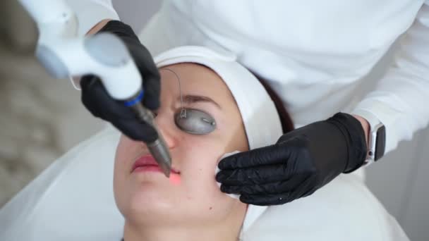 Zbliżenie Zdjęcie Specjalisty Kosmetologii Przy Użyciu Urządzeń Laserowych Erbium Yag — Wideo stockowe
