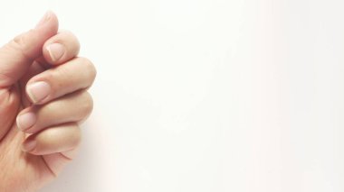 Kuru ve çatlamış sol el.