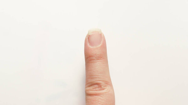 Index finger with cracked and sore nail