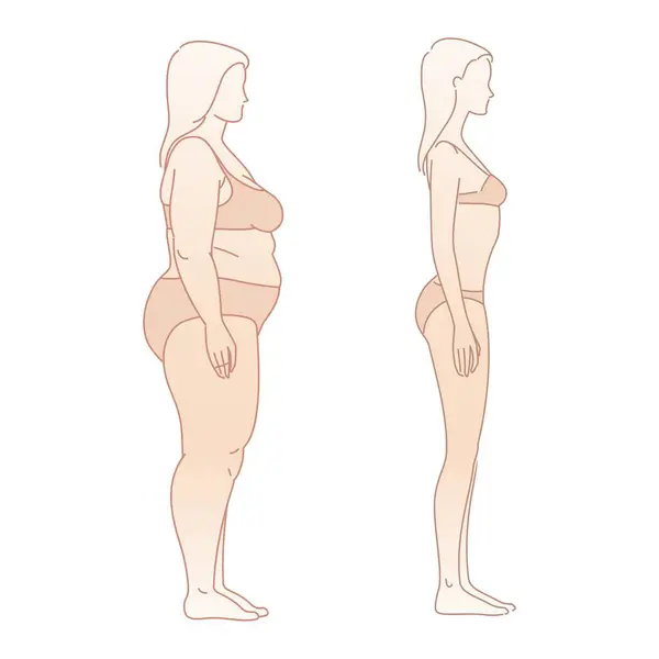 다이어트 Emaciation 과체중 실루엣 5개의 3개인 앞면을 나타냅니다 일러스트 스톡 일러스트레이션