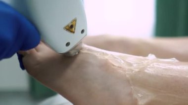 Güzel, genç, seksi bir kız, güzellik salonunda lazer kılları alıyor, koltuk altlarını ve kollarını çıkarıyor, kendine özen ve güzellik, epilasyon ve güzel bir vücut.