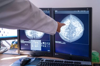 LVIV, UKRAINE, Eylül 28, 2023 Lviv Kanser Merkezi